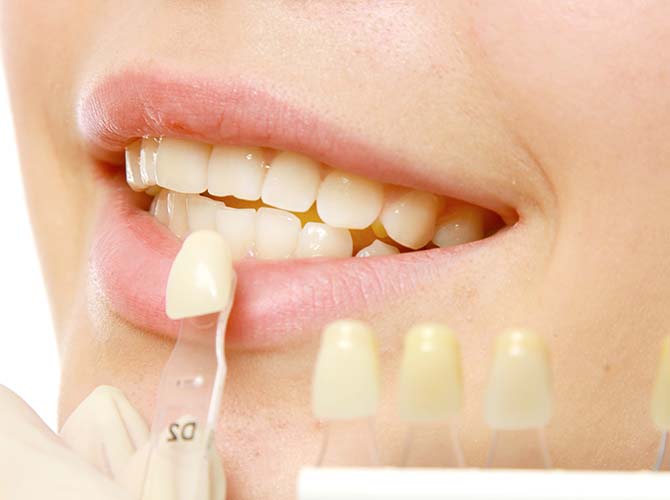 restorative dental treatments